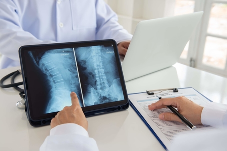 doctor pointing at x-ray of spine
